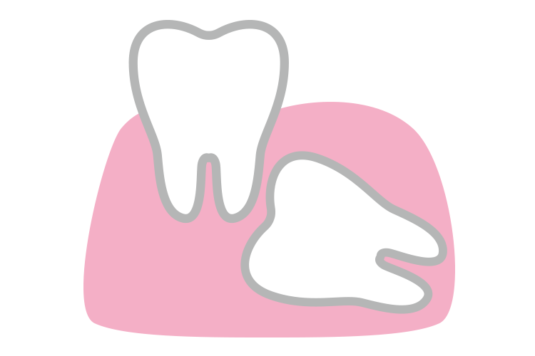歯科口腔外科とは